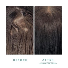 We Are Paradoxx Growth Advanced Scalp Serum 50 ml / 1.69 fl oz