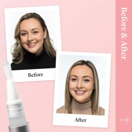 Spotlight Oral Care Teeth Whitening Pen